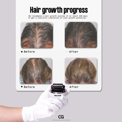 ערכת צמיחת שיער לגברים לטיפוח קופנהגן עם סרום צמיחת שיער מפעיל וממריץ זקיק השיער מונרולר-טיפול