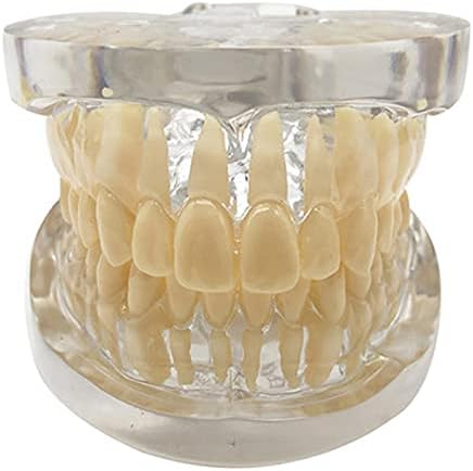 מודל שיני שיניים של KH66Zky - דגם לימוד שיניים שיניים - דגם לימוד קריסטל ברור דגם שיניים שקופות, ורוד