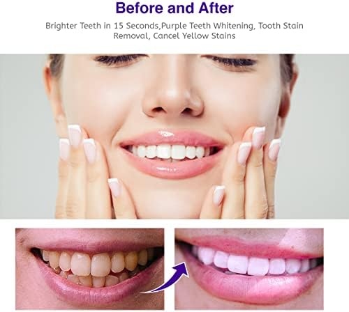 הלבנת שיניים סגולות, הסרת כתמי שיניים, מגבר הלבנת שיניים, קצף שן הלבנת סגול, משחת שיניים סגולה ויר （50 מל）